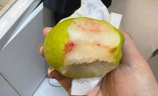 Yellow teeth holding you back? Nobaton is here to solve it completely!